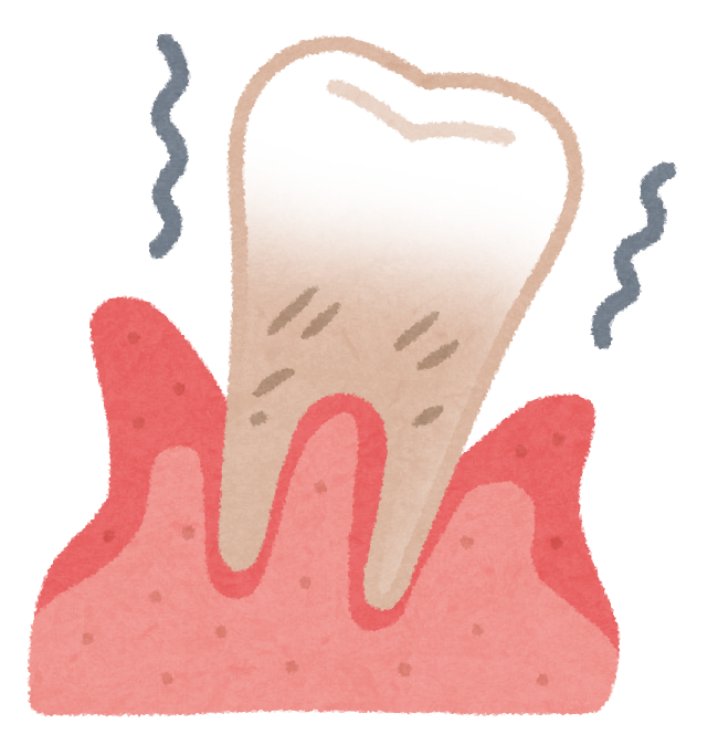 最近歯が長くなってきていませんか なかもず松浦歯科医院