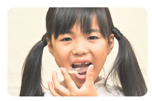 仮歯の特徴